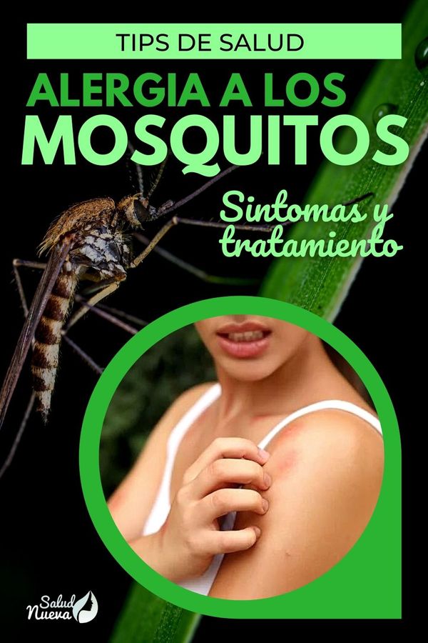 alergia a los mosquitos (1)