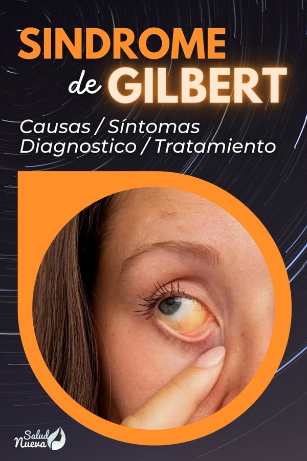 sindrome de gilbert que es causas y sintomas