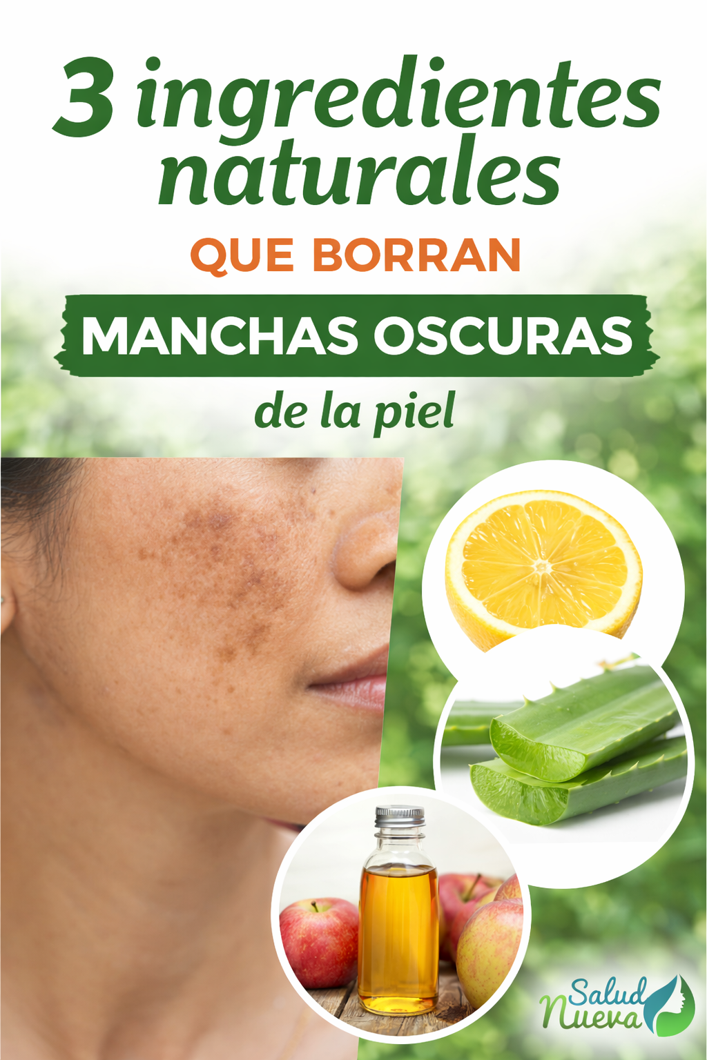 3 ingredientes naturales para eliminar manchas oscuras de la piel