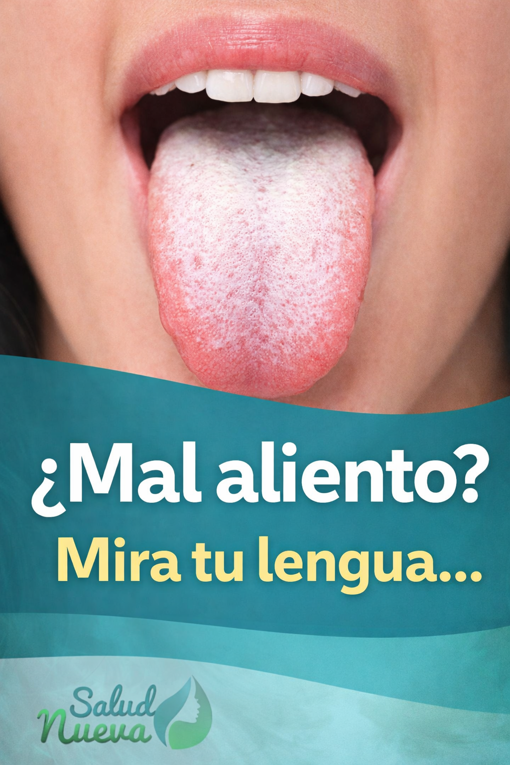 Mal aliento y lengua blanca: causas y cómo eliminarlo