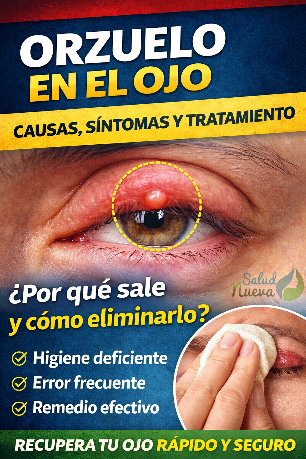 Primer plano de un ojo con un orzuelo visible en el párpado superior, resaltado con un círculo, acompañado de texto en español sobre causas, síntomas y cómo eliminarlo, en diseño tipo Pinterest con el logo de Salud Nueva en la esquina.