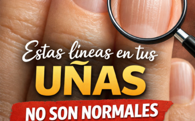 Primer plano hiperrealista de uñas con líneas verticales visibles, destacadas con una lupa, acompañado de texto llamativo en español que advierte “Estas líneas en tus uñas no son normales” y menciona su relación con la salud y cómo eliminarlas.