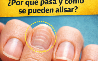 Primer plano de uñas onduladas con superficie irregular, destacadas con un círculo, acompañado de texto en español sobre sus causas y soluciones naturales, con diseño llamativo tipo Pinterest y logo de Salud Nueva en la esquina.