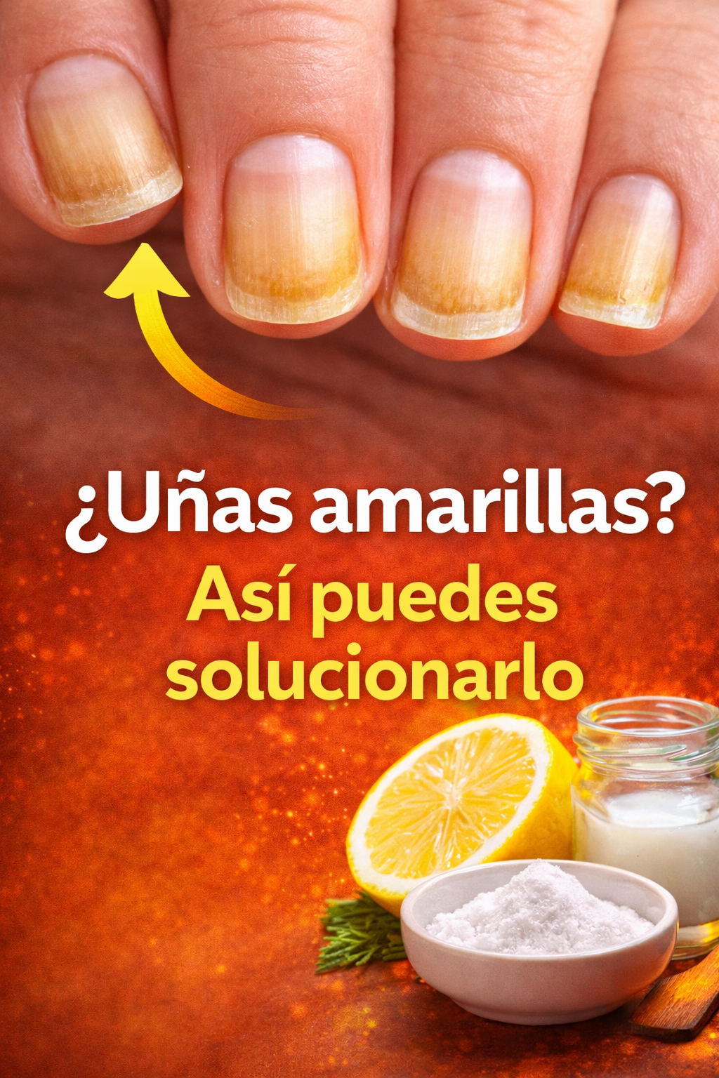 Primer plano de uñas amarillas con decoloración visible, acompañado de remedios naturales como limón, bicarbonato y aceite, con texto que indica cómo solucionarlo.