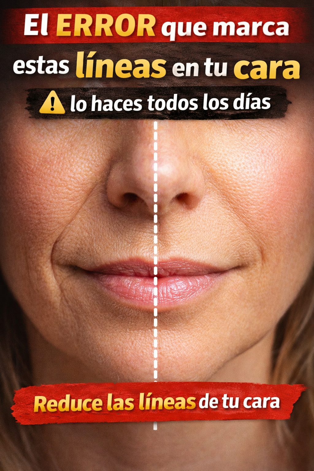 cómo reducir los surcos nasogenianos y suavizar las líneas de la sonrisa